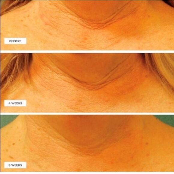 PERRICONE MD COLD PLASMA PLUS+ NECK & CHEST BROADSPECTRUM SPF 25 - Picture 6 of 10